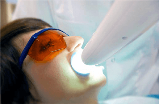 Understanding the Causes of Teeth Sensitivity Carlisle