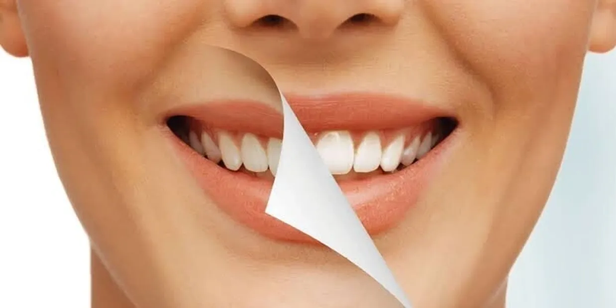 What Is Cosmetic Dentistry and How Can It Transform Your Smile Carlisle