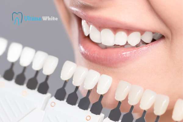 How to Maximise the Results of Your Laser Teeth Whitening Treatment Carlisle