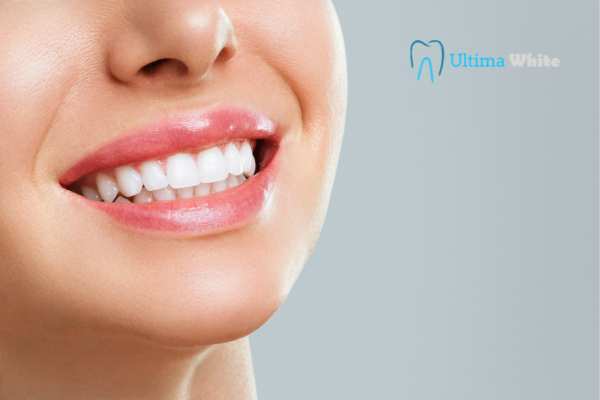 Common Mistakes That Can Ruin Your Whitening Results Carlisle
