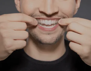 Overview of Home Teeth Whitening Kits Carlisle