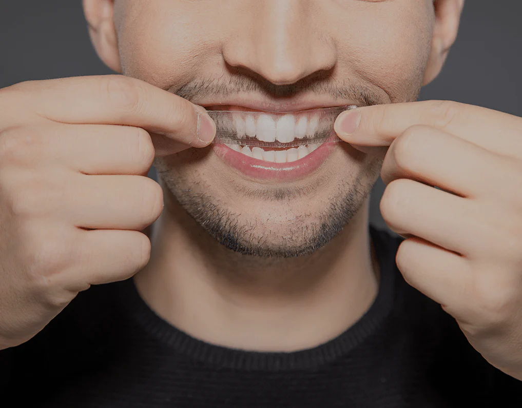 Can You Whiten Natural Teeth Without Harsh Chemicals Carlisle?