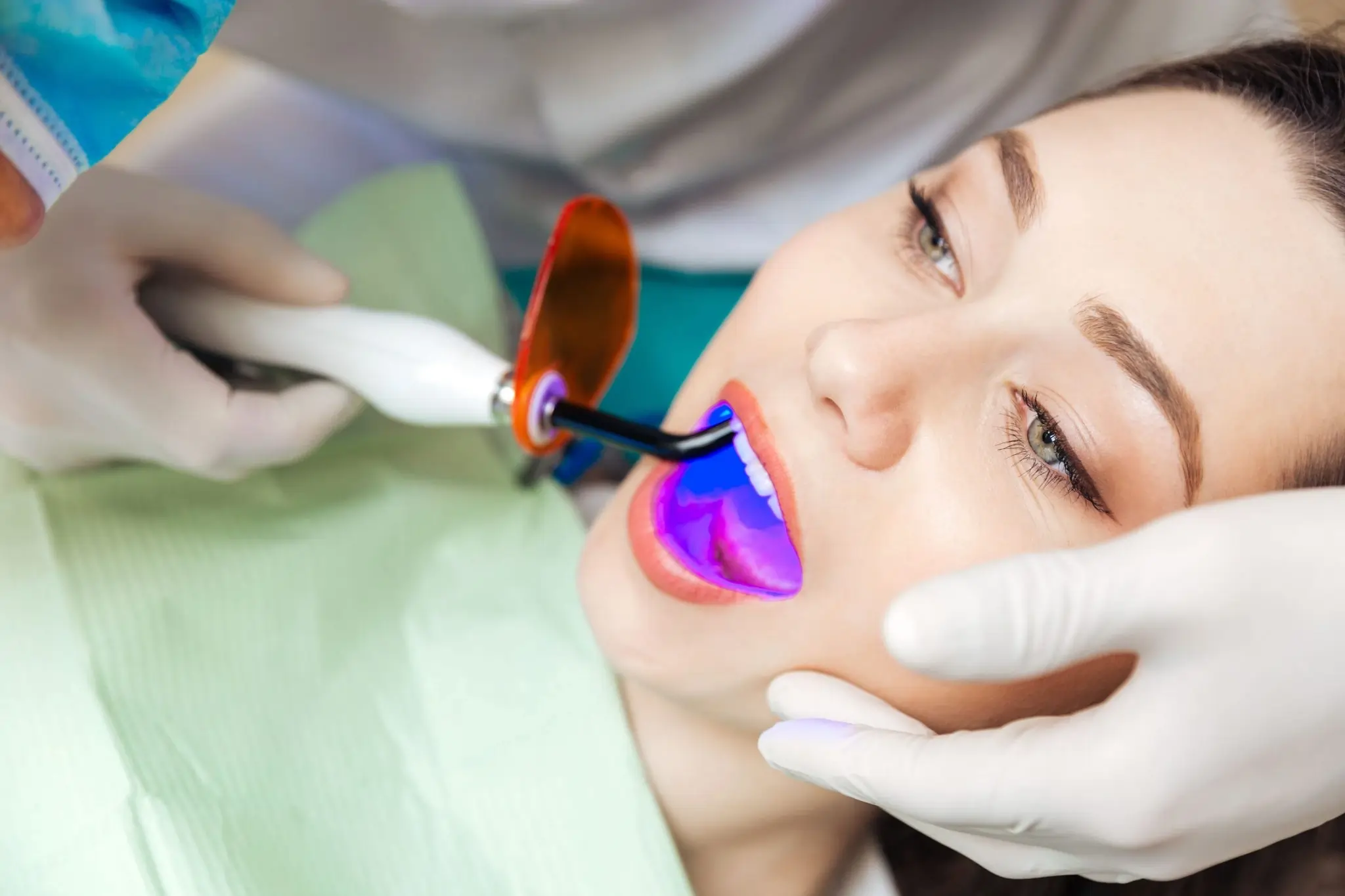 When Should You Stop DIY Whitening and Consider Professional Treatment Instead Carlisle?