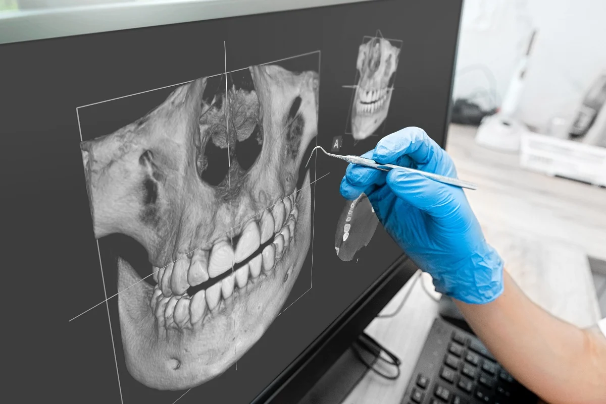 How Is AI Transforming Dental Treatment Planning Carlisle?