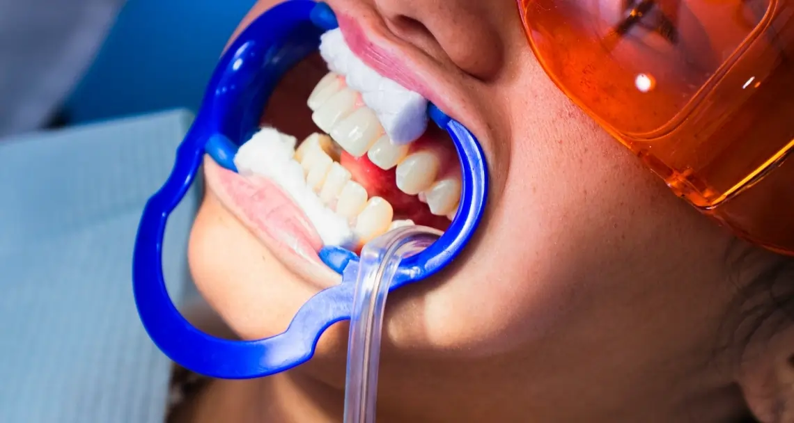 How Can Cosmetic Dentistry Boost Your Confidence Carlisle