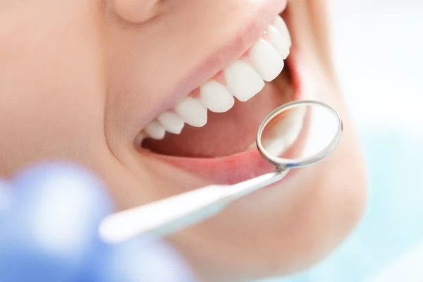 The Complete Guide to Laser Teeth Whitening Results and Aftercare