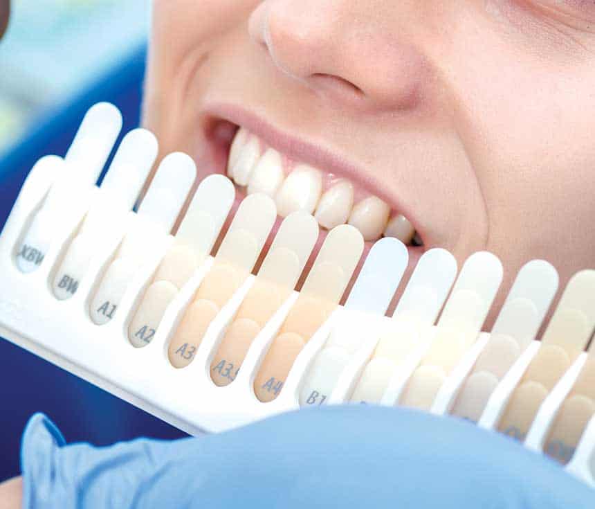 Is Laser Teeth Whitening Worth It for a Brighter, Confident Smile Carlisle?