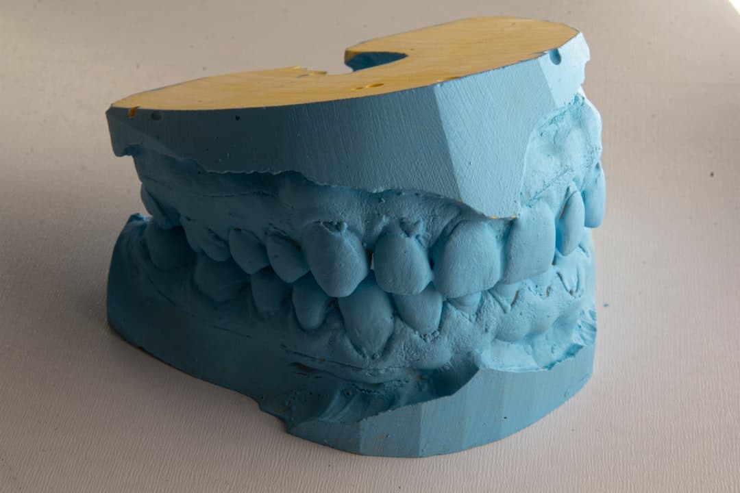 How Do Dental Implants Improve Jawbone Health and Oral Function Carlisle?