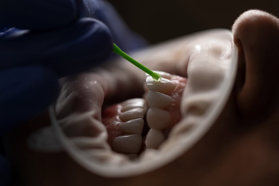 Common Causes of Persistent Dry Mouth Carlisle