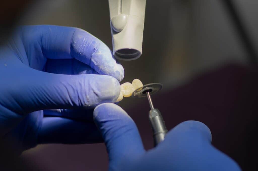 Customised Dental Solutions: Crowns, Aligners, and Implants Carlisle