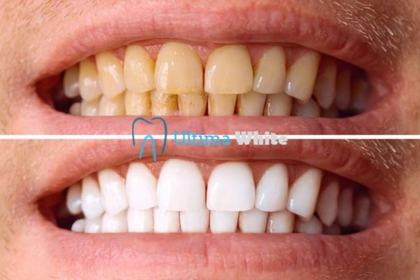 Stained Teeth and Persistent Bad Breath Carlisle